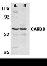 CARD9 Antibody in Western Blot (WB)