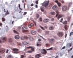 PUMA alpha Antibody in Immunohistochemistry (Paraffin) (IHC (P))