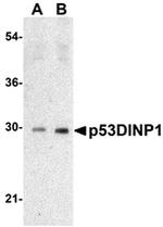 p53DINP1 Antibody in Western Blot (WB)