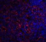 CD268 (BAFF Receptor) Antibody in Immunohistochemistry (IHC)