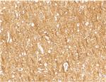 TEM8 Antibody in Immunohistochemistry (IHC)