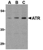 TEM8 Antibody in Western Blot (WB)