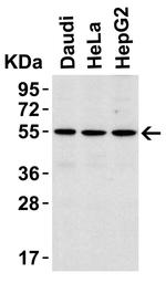 IRAK4 Antibody in Western Blot (WB)