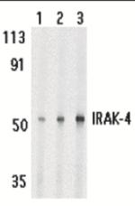 IRAK4 Antibody in Western Blot (WB)