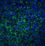 TLR4 Antibody in Immunohistochemistry (IHC)