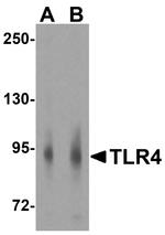 TLR4 Antibody in Western Blot (WB)