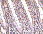 PHAP Antibody in Immunohistochemistry (IHC)