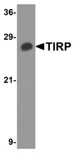 TICAM2 Antibody in Western Blot (WB)