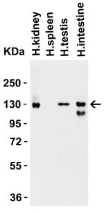 ACE2 Antibody in Western Blot (WB)