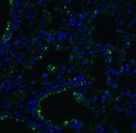 ACE2 Antibody in Immunohistochemistry (PFA fixed) (IHC (PFA))