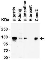 ACE2 Antibody in Western Blot (WB)