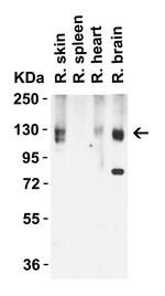 ACE2 Antibody in Western Blot (WB)