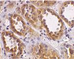 ACE2 Antibody in Immunohistochemistry (Paraffin) (IHC (P))