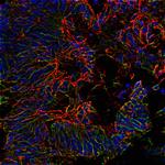 ACE2 Antibody in Immunocytochemistry (ICC/IF)