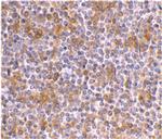 APOBEC3G Antibody in Immunohistochemistry (IHC)