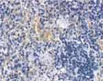 MD-2 Antibody in Immunohistochemistry (Paraffin) (IHC (P))