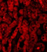 TICAM2 Antibody in Immunocytochemistry (ICC/IF)