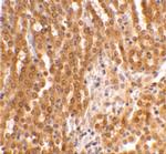 TICAM2 Antibody in Immunohistochemistry (IHC)