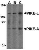 CENTG1 Antibody in Western Blot (WB)