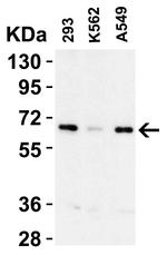 cIAP1 Antibody in Western Blot (WB)