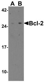 Bcl-2 Antibody in Western Blot (WB)