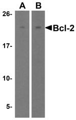 Bcl-2 Antibody in Western Blot (WB)