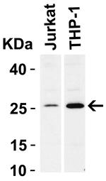 Bcl-2 Antibody in Western Blot (WB)