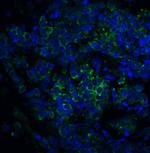 ST2 Antibody in Immunohistochemistry (IHC)