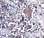 ST2 Antibody in Immunohistochemistry (IHC)