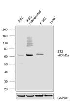 ST2 Antibody in Western Blot (WB)