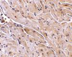 RNF216 Antibody in Immunohistochemistry (IHC)