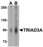 RNF216 Antibody in Western Blot (WB)