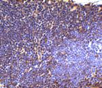 UBC13 Antibody in Immunohistochemistry (IHC)