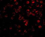 TAB1 Antibody in Immunocytochemistry (ICC/IF)