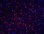 Btk Antibody in Immunohistochemistry (IHC)