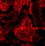 IRF3 Antibody in Immunocytochemistry (ICC/IF)