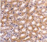 IRF3 Antibody in Immunohistochemistry (IHC)