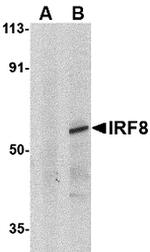 IRF8 Antibody in Western Blot (WB)