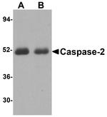 Caspase 2 Antibody in Western Blot (WB)