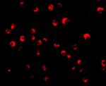 Caspase 8 Antibody in Immunocytochemistry (ICC/IF)