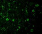 RHEB Antibody in Immunocytochemistry (ICC/IF)