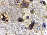 RHEB Antibody in Immunohistochemistry (IHC)