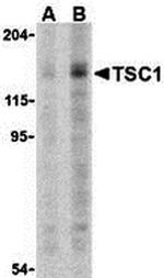 TSC1 Antibody in Western Blot (WB)