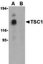 TSC1 Antibody in Western Blot (WB)