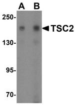 TSC2 Antibody in Western Blot (WB)