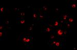 TSC2 Antibody in Immunocytochemistry (ICC/IF)