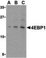 4EBP1 Antibody in Western Blot (WB)