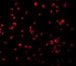 IRS1 Antibody in Immunocytochemistry (ICC/IF)