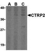 CTRP2 Antibody in Western Blot (WB)