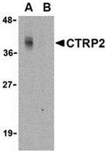 CTRP2 Antibody in Western Blot (WB)